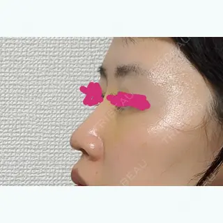 8日目の経過画像（2枚目）