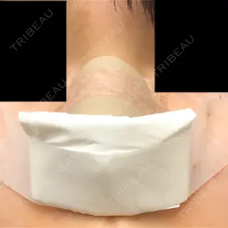 1日目の経過画像（3枚目）