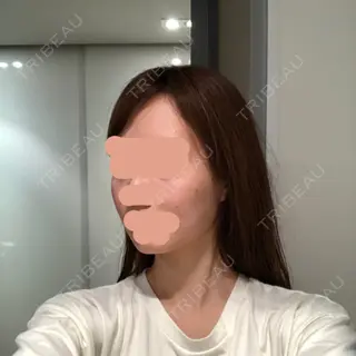 15日目の経過画像（3枚目）