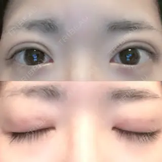 8日目の経過画像（1枚目）