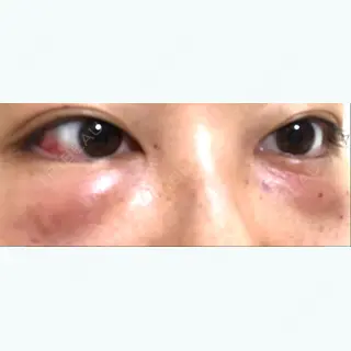 1日目の経過画像（1枚目）