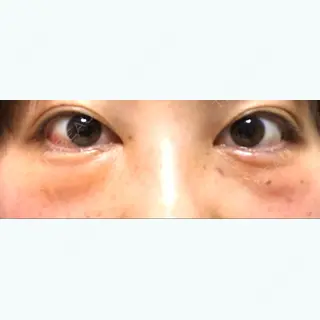 2日目の経過画像（1枚目）