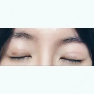 4日目の経過画像（3枚目）