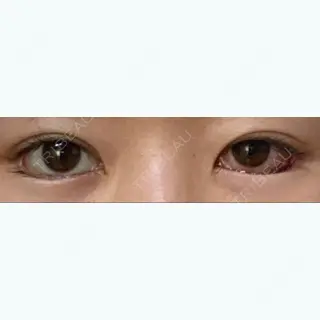 7日目の経過画像（1枚目）