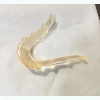 15日目の経過画像（3枚目）