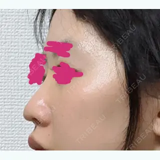 10日目の経過画像（2枚目）