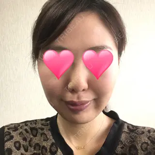 9日目の経過画像（2枚目）