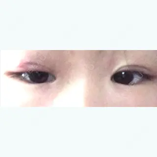 17日目の経過画像（2枚目）