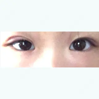 17日目の経過画像（1枚目）