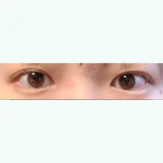 9日目の経過画像（1枚目）