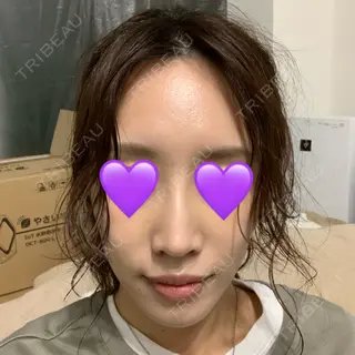 5日目の経過画像（1枚目）