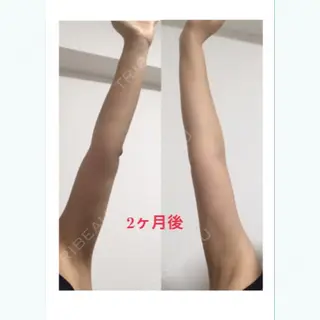 61日目の経過画像（1枚目）