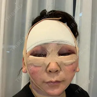 0日目の経過画像（1枚目）