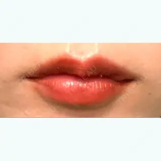 1日目の経過画像（1枚目）