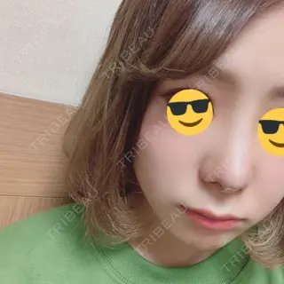 7日目の経過画像（1枚目）