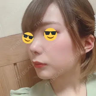 8日目の経過画像（1枚目）