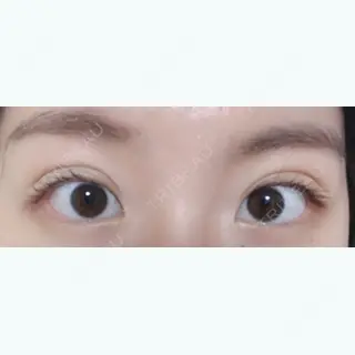 7日目の経過画像（2枚目）