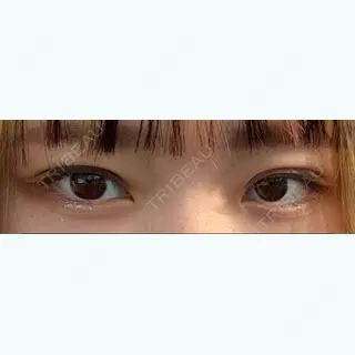 7日目の経過画像（1枚目）