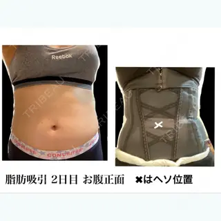 1日目の経過画像（2枚目）