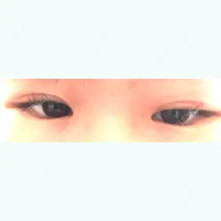 20日目の経過画像（2枚目）