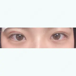1日目の経過画像（1枚目）
