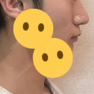 19日目の経過画像（2枚目）