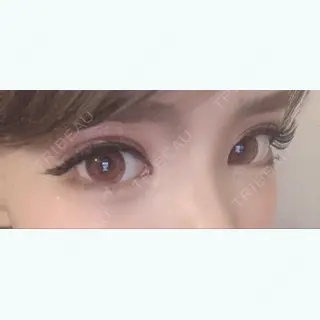 7日目の経過画像（2枚目）