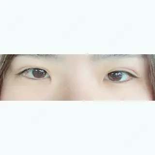 3日目の経過画像（1枚目）