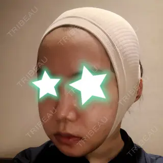 3日目の経過画像（2枚目）