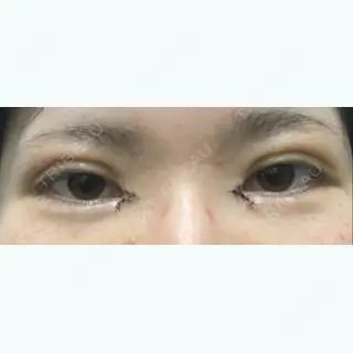 7日目の経過画像（1枚目）