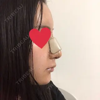 3日目の経過画像（2枚目）