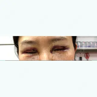 2日目の経過画像（2枚目）