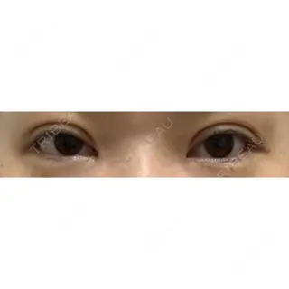 20日目の経過画像（1枚目）