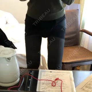 1日目の経過画像（3枚目）