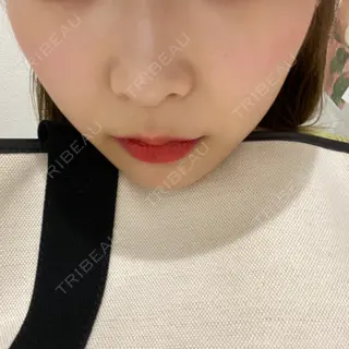 63日目の経過画像（1枚目）