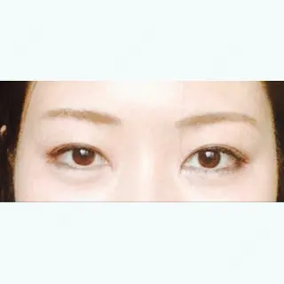 2日目の経過画像（1枚目）