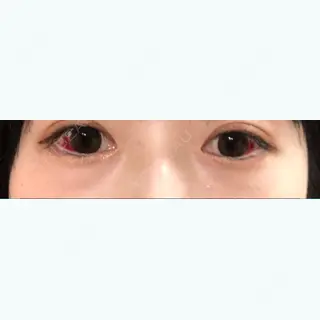 21日目の経過画像（1枚目）