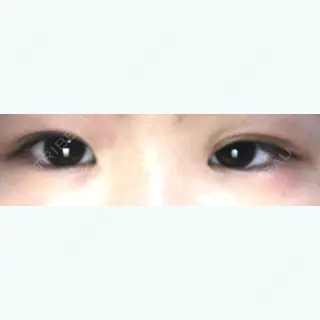 22日目の経過画像（1枚目）