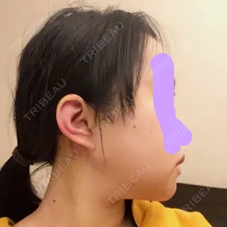 4日目の経過画像（3枚目）
