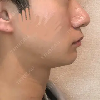 21日目の経過画像（2枚目）