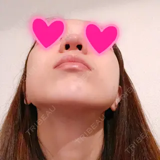 1日目の経過画像（3枚目）
