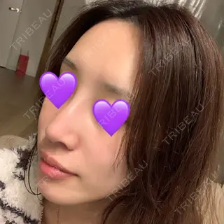 11日目の経過画像（2枚目）