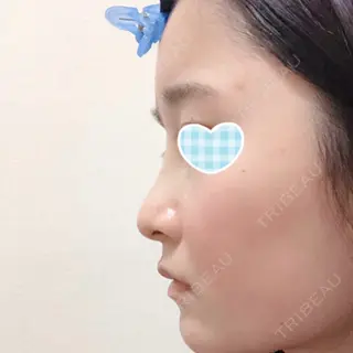 3日目の経過画像（1枚目）