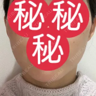 31日目の経過画像（1枚目）