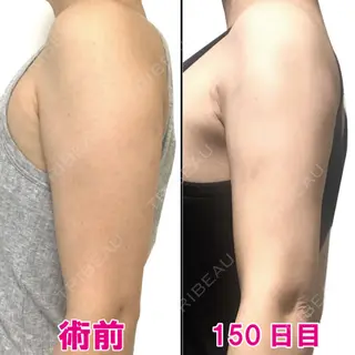 150日目の経過画像（1枚目）