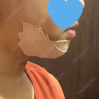 2日目の経過画像（2枚目）