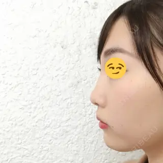 2日目の経過画像（2枚目）