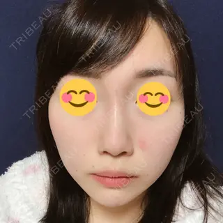 5日目の経過画像（1枚目）