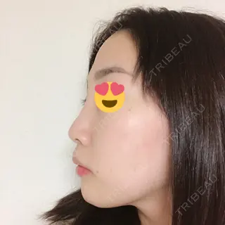 10日目の経過画像（2枚目）