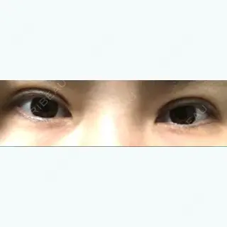 30日目の経過画像（1枚目）